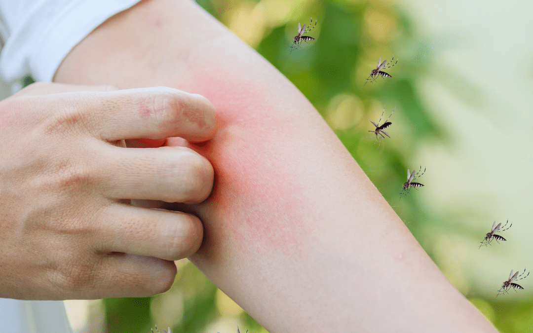 Mosquitoes swarming around an arm.